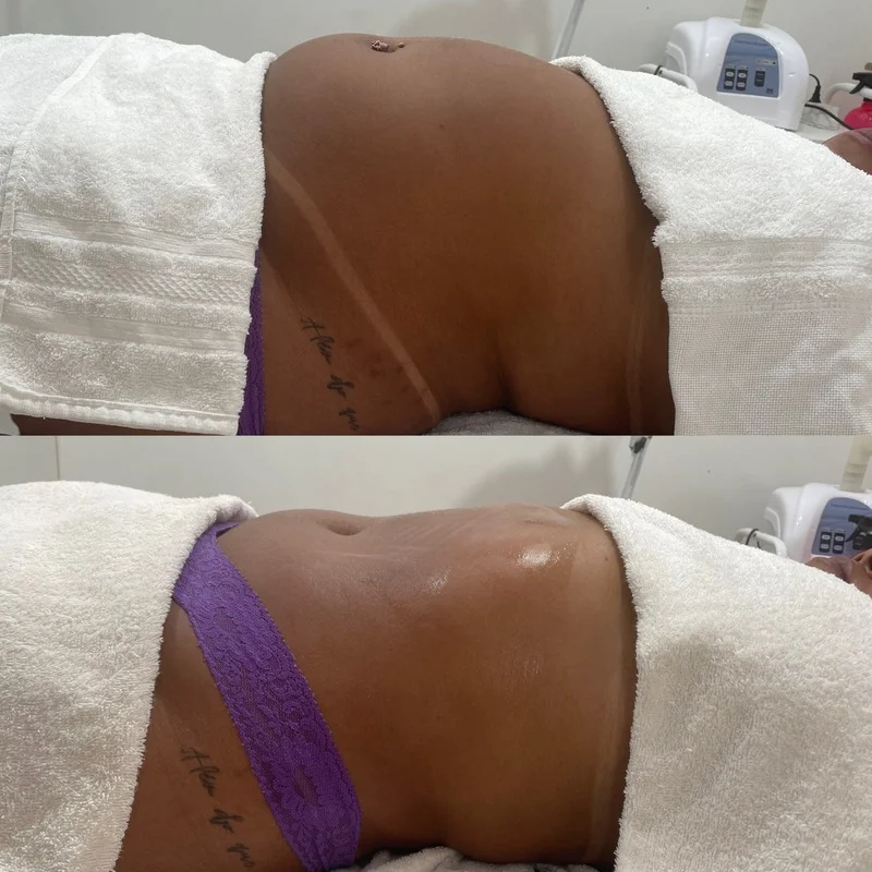 Procedimento por Fernanda Rocha